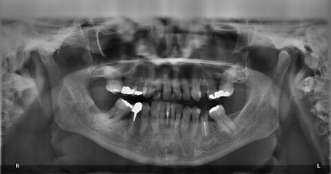 What Can Forensic Odontology be Used For? - The Dr. Samuel D. Harris ...